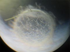 顕微鏡で見たメダカの卵